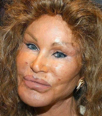 Jocelyne Wildenstein   qui a voulu ressembler à une panthère pour plaire à son mari !